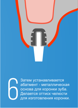 6.png